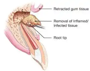 endo surgery 1