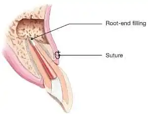 endo surgery 2